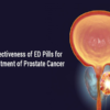 The Effectiveness of ED Pills for the Treatment of Prostate Cancer