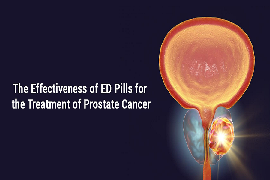 The Effectiveness of ED Pills for the Treatment of Prostate Cancer